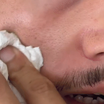 EXFOLIANTE PEEL SHOT DE ARROZ NEGRO